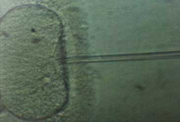 ICSI-intra-cytoplasmic-sperm3