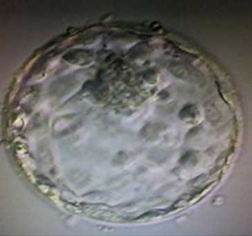 Expanded Blastocyst