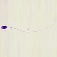 Normal Sperm