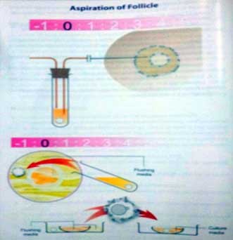 Oocyte Handling